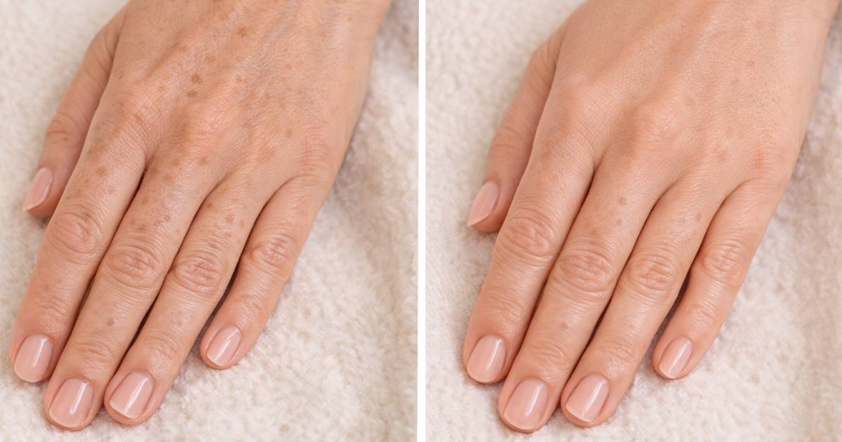 "40 yaşında çok daha az lekem var" Bu Tipoloji yaşlanma karşıtı el kremi elleri gözle görülür şekilde gençleştirir
