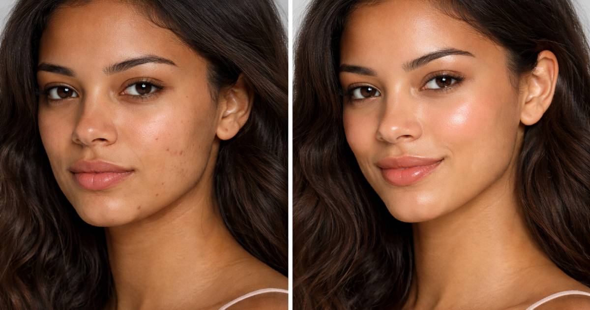 "artık sivilcelerim yok" 6 $ karşılığındaki bu Kore kremi kusurları tedavi eder ve cildi derinlemesine nemlendirir