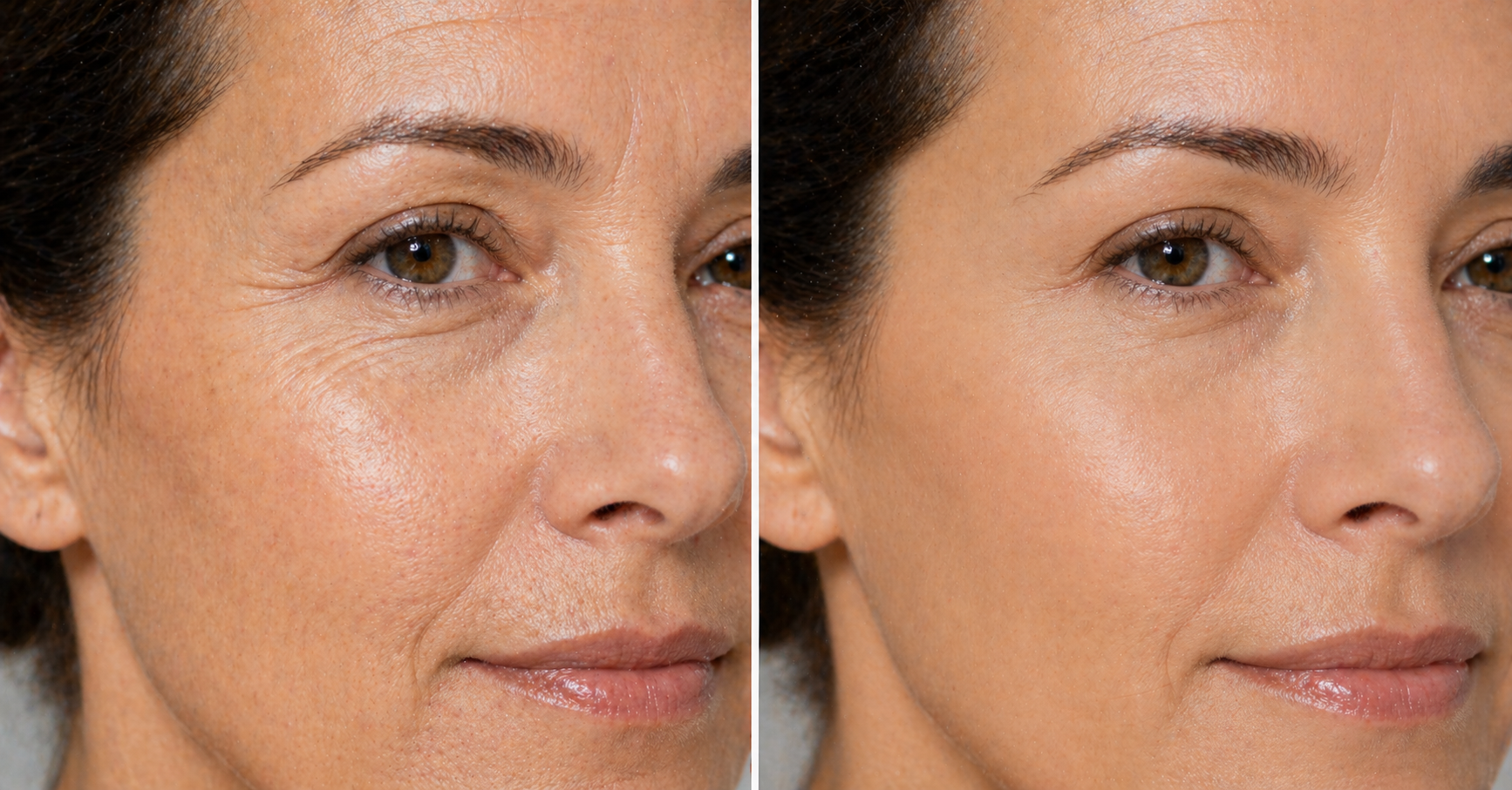 "8 haftada -%18 kırışıklık" : Kolajen içen bu Vital Proteins zaten stokta yok (ve nedenini anlıyoruz)
